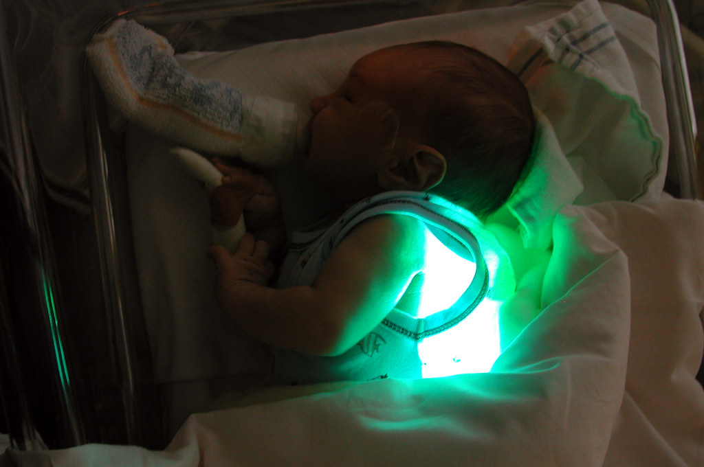 Light for Jaundice at Home