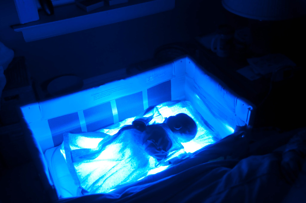 Photo Light Therapy for Newborns