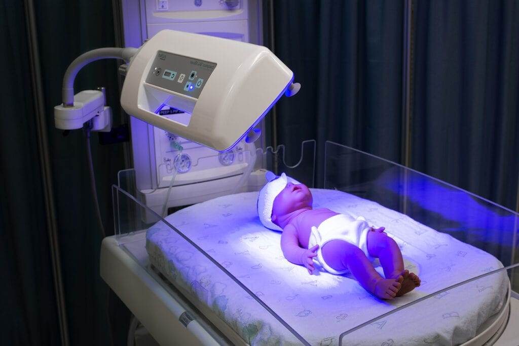 Phototherapy Procedure Newborn