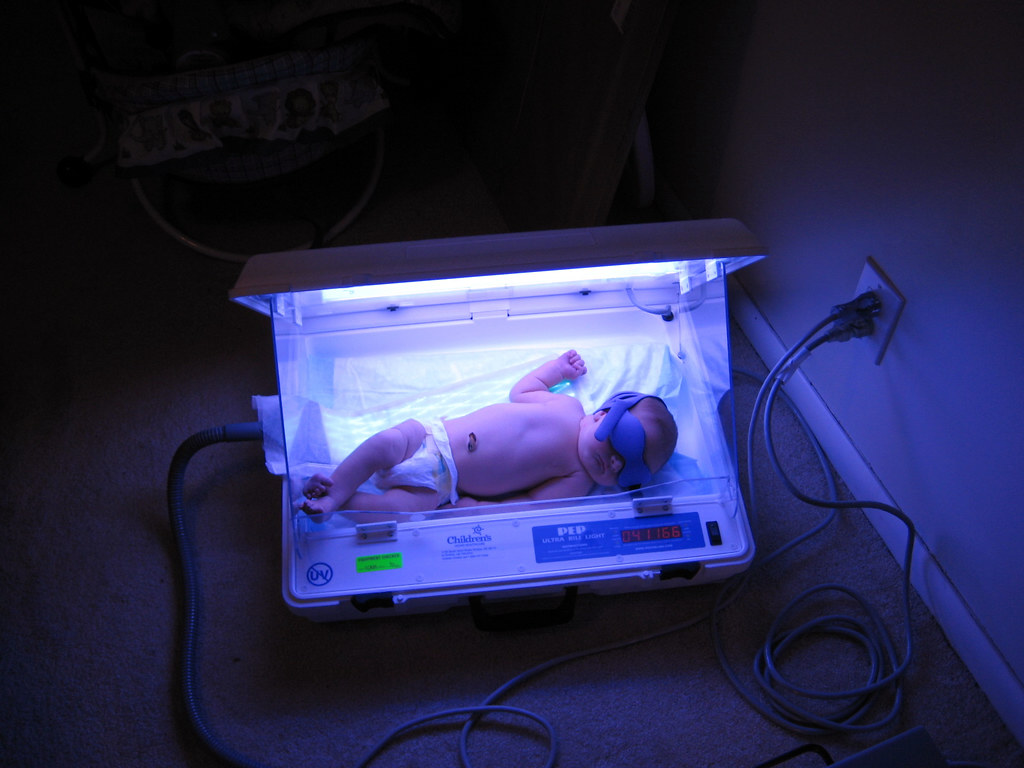 Phototherapy for Jaundice Near Me