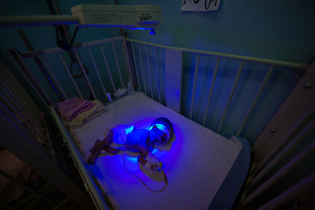 Phototherapy for Jaundice