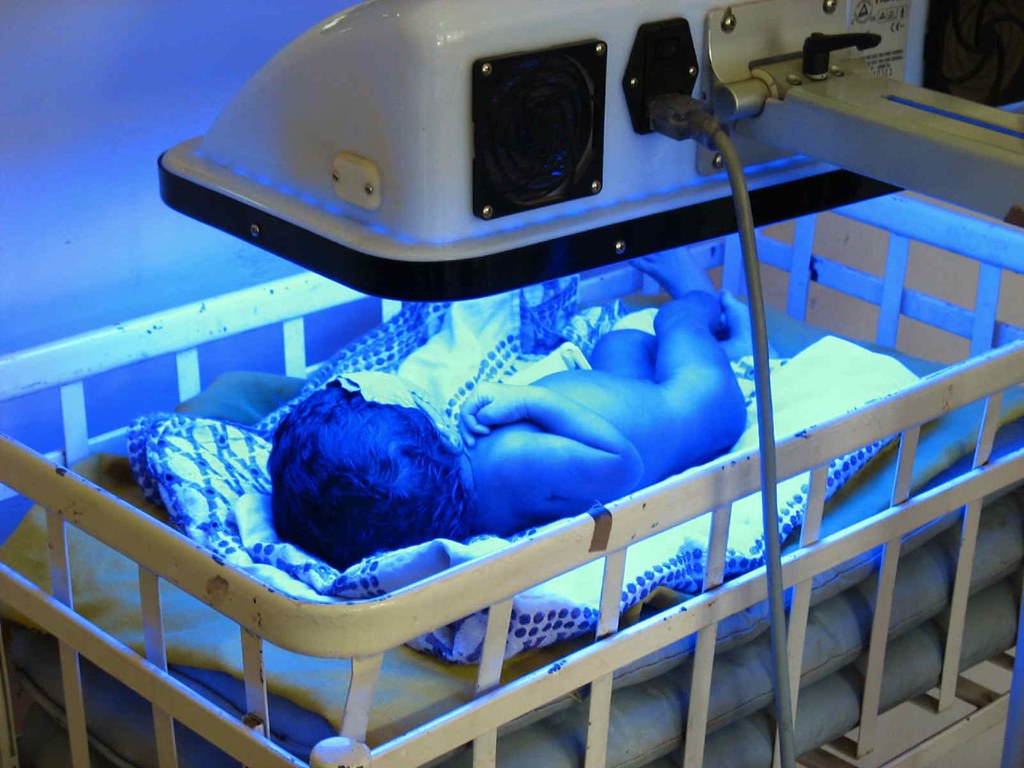 Phototherapy for Newborn Cost