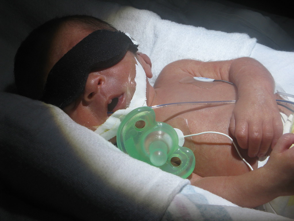 UV Light for Neonatal Jaundice