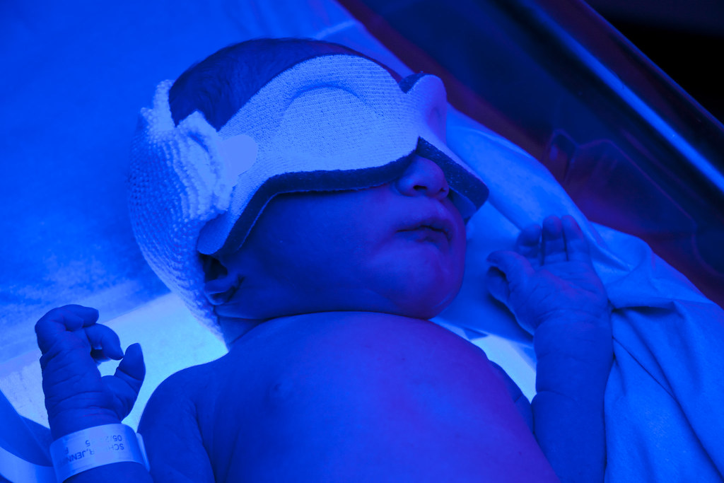 UV Light for Newborn Jaundice