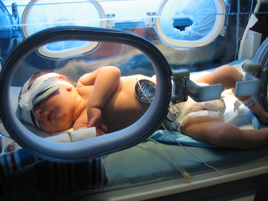 phototherapy treatment for neonatal jaundice